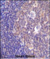 PIK3R5 Antibody (C-term)